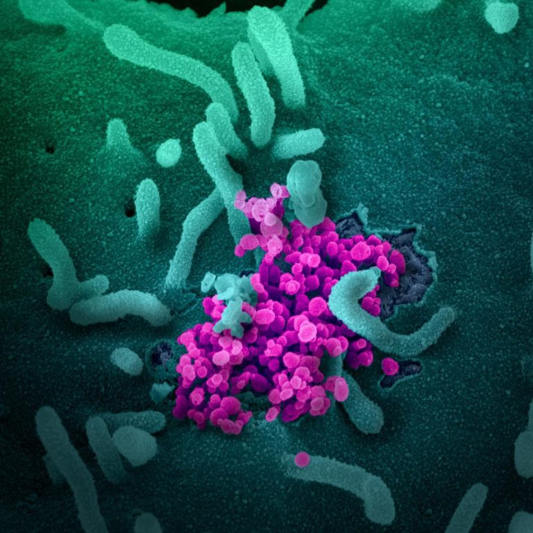 SARS-CoV-2 virus circulates Worldwide without clear seasonality and continues to infect