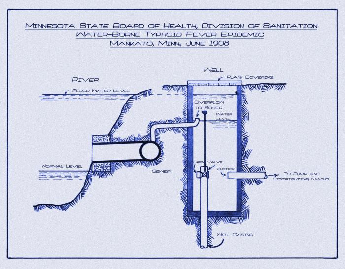 Typhoid Fever Epidemic struck Mankato, Minnesota