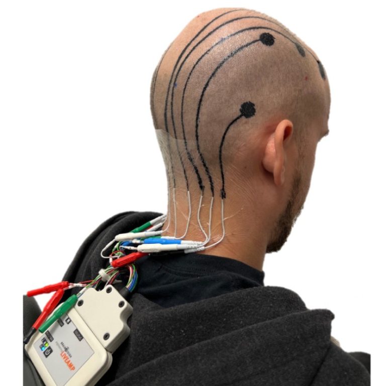 personalized electroencephalography e-tattoos printed On-scalp