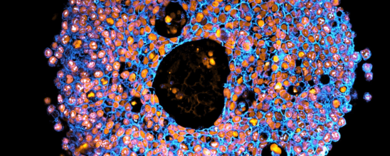 3D bioprinted mini placentas could transform pregnancy research