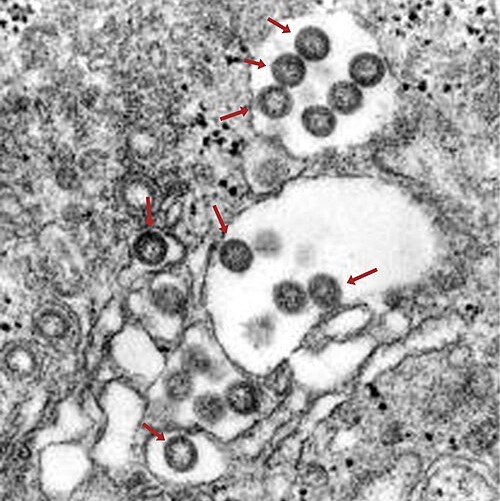 WHO Reports Rift Valley fever in  Mauritania and Senegal