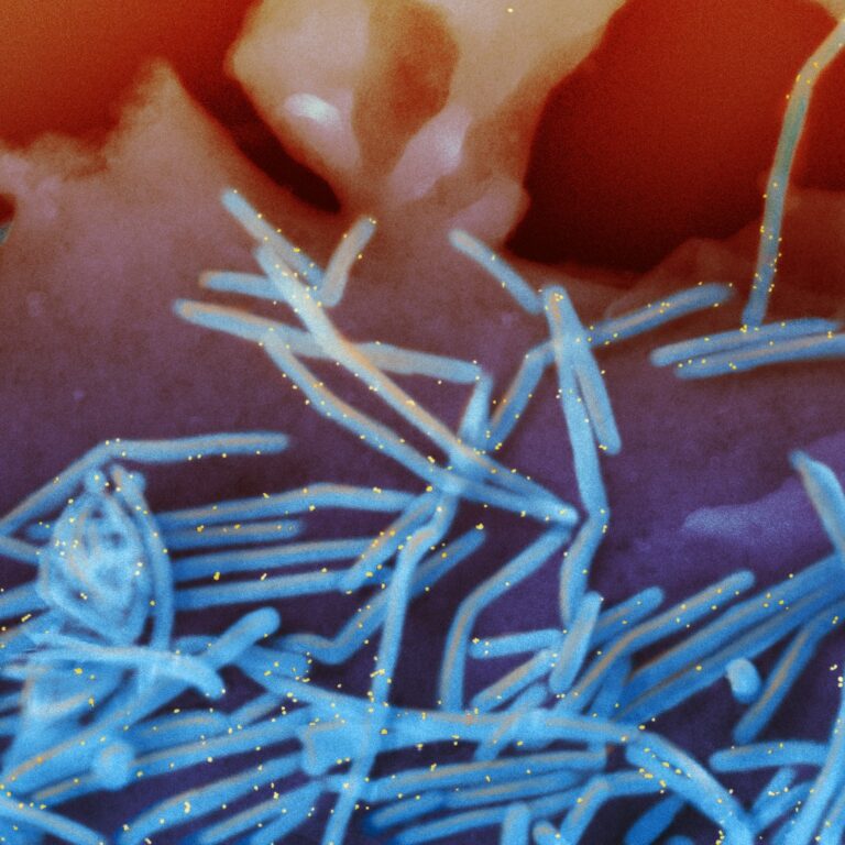 Flu, RSV activity rising in US and Europe, with major UK surge in flu cases