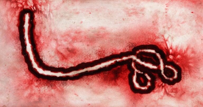 US provides Ebola treatment for outbreak in Congo, bringing trials closer